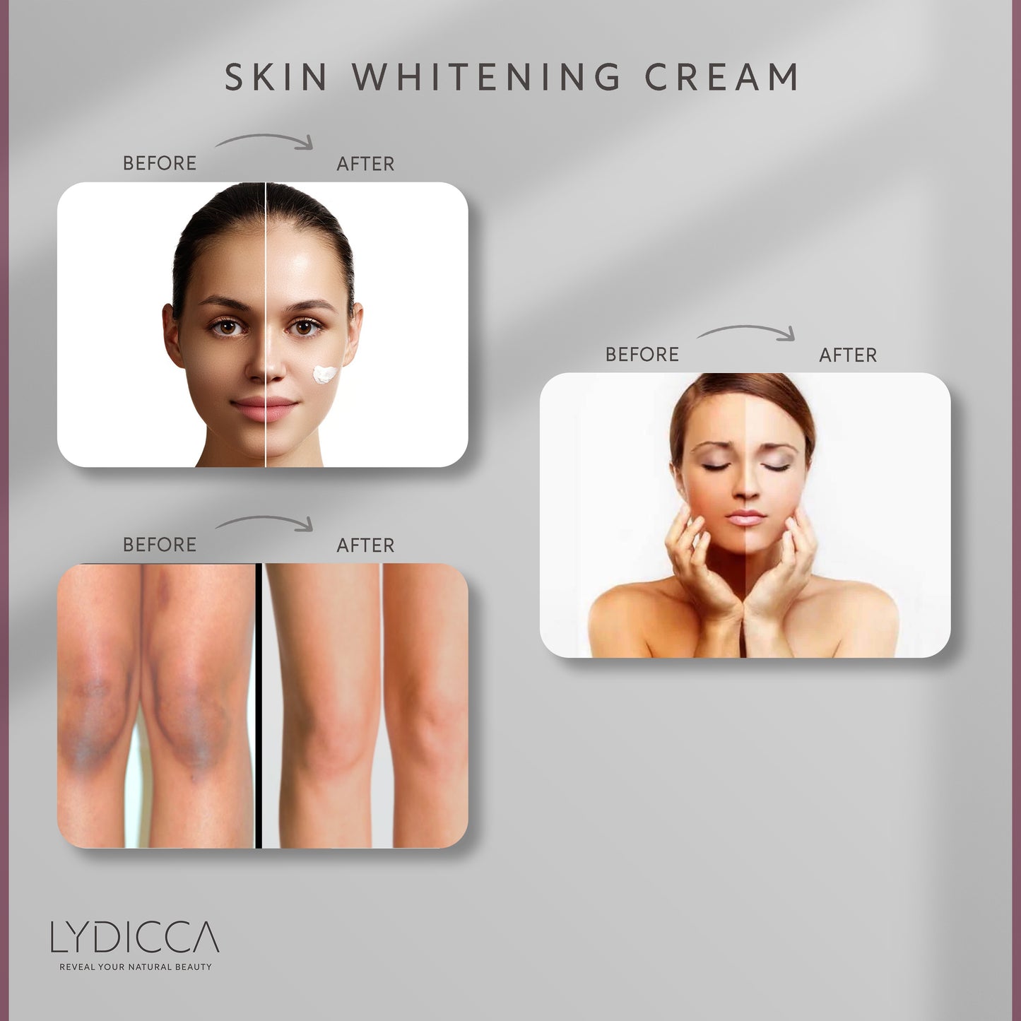 Skin Whitening Cream – Luliana